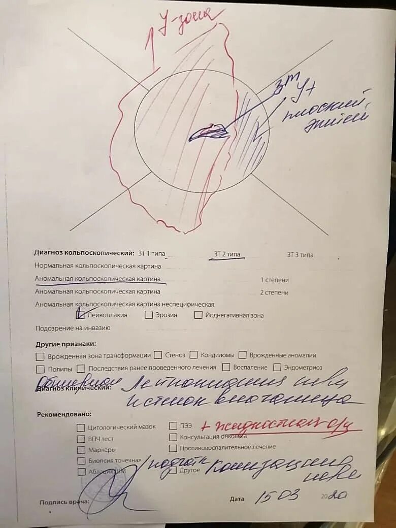 Картина кольпоскопии. Кольпоскопическая картина лейкоплакии. протокол кольпоскопии. диагноз кольпоскопический. аномальная кольпоскопическая картина 2 типа.
