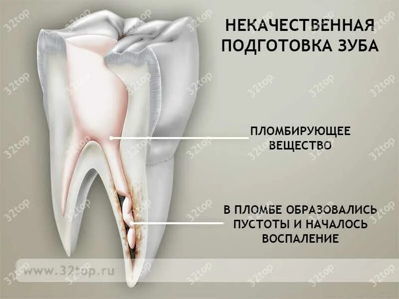 Болит зуб. Больно стучать по зубу