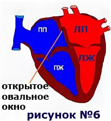 1 3 окно в сердце. Открытое овальное окно. Открытое овальное окошко в сердце. Овальное окно в сердце. Открыто овальное окно в сердце.