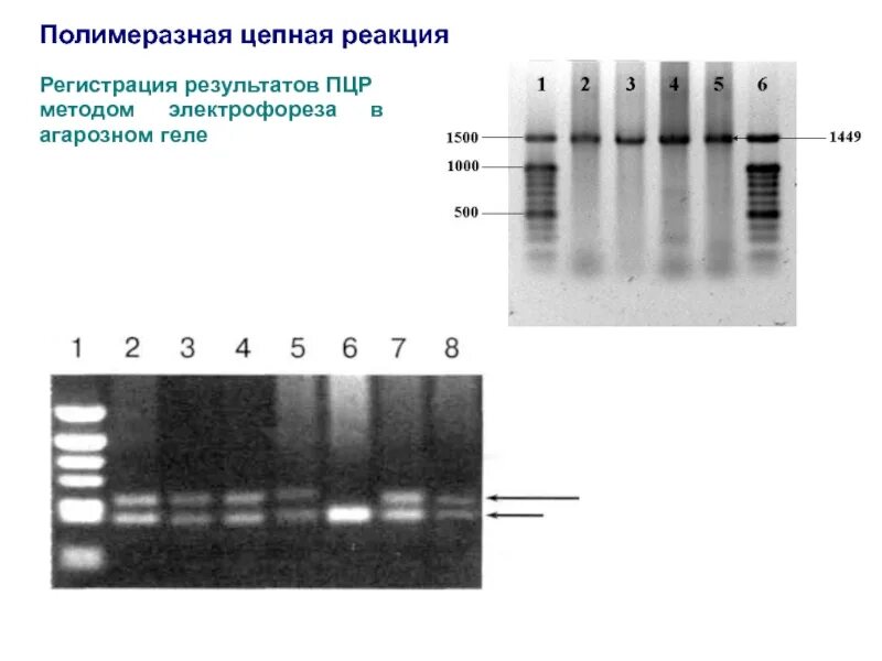 Пцр тест качественное. Детекция продукта ПЦР электрофорезом. Гель-электрофоретическая детекция ПЦР-продукта. Метод горизонтального электрофореза в агарозном геле. Детекция результатов ПЦР электрофорез.