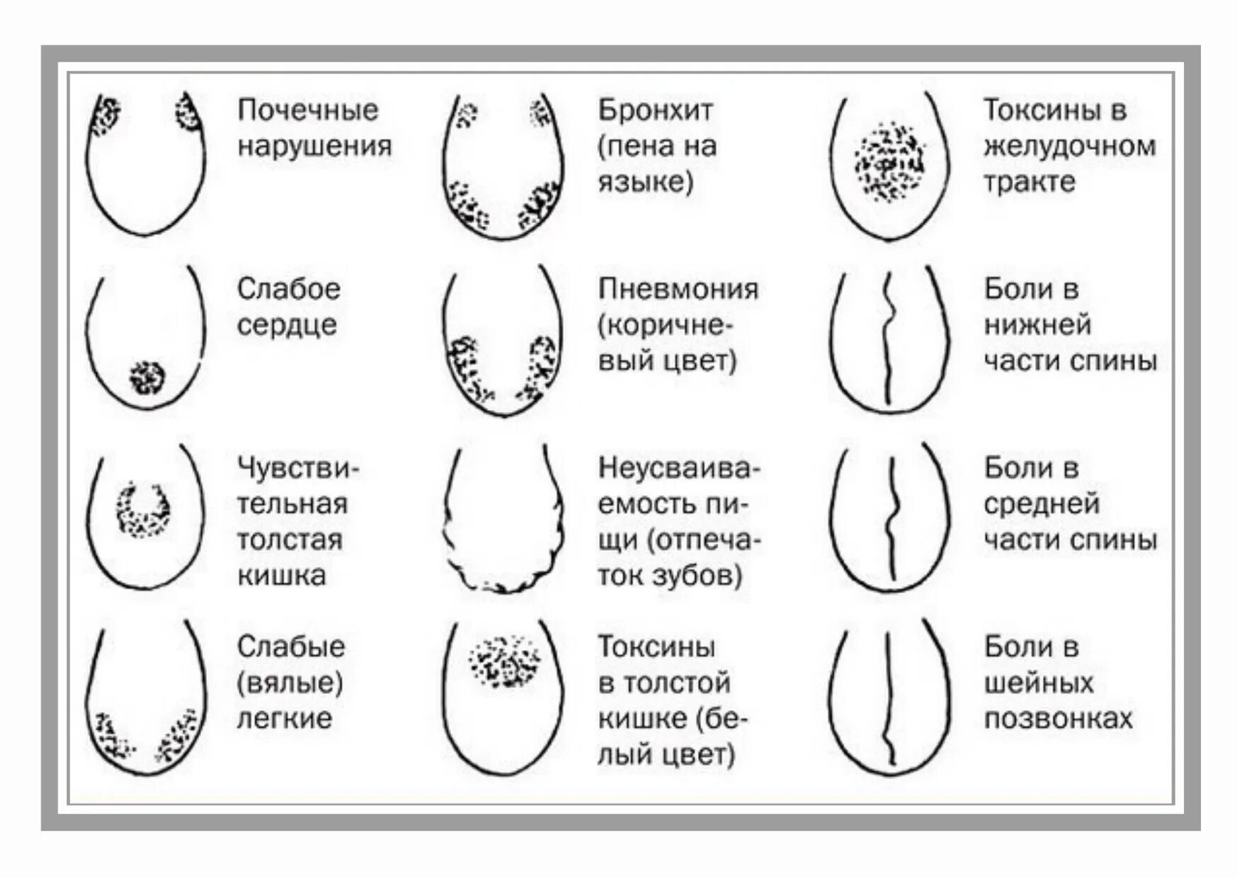 Форма головки члена. Болезни по языку определить. Диагностика по языку человека. Заболевание по цвету языка у человека.