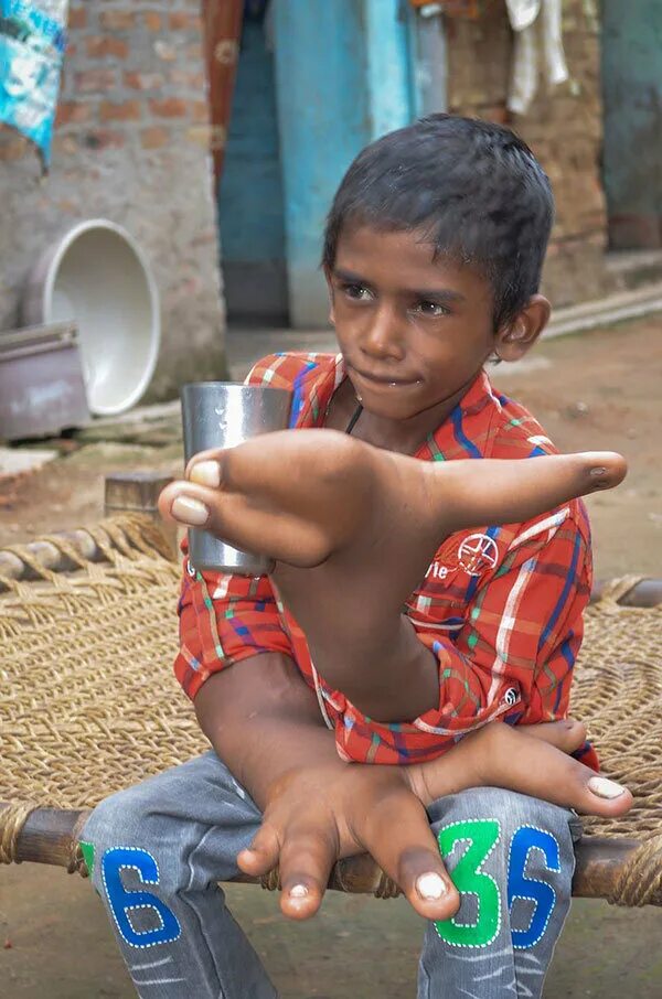 Маленький индийский мальчик. Индийский мальчик с гигантскими руками. Child penis