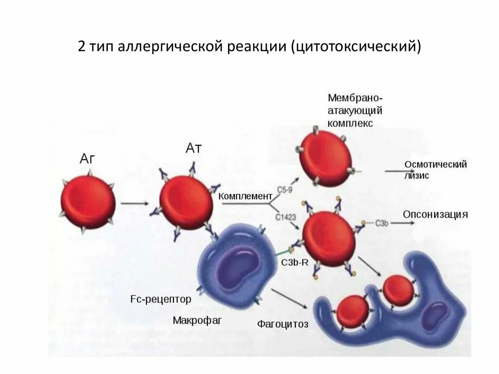 Аллергическая анемия. Гемолитическая анемия патогенез схема. Гемолитическая анемия Тип аллергической реакции. Патогенез аутоиммунных анемий. Аутоиммунная гемолитическая анемия схема.