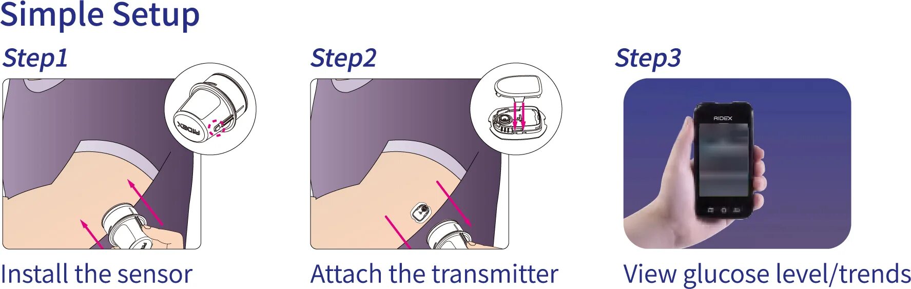 CGM-монитор Continuous glucose Monitor. CGM датчик. CGM System мониторинг сахара. AIDEX мониторинг сахара.