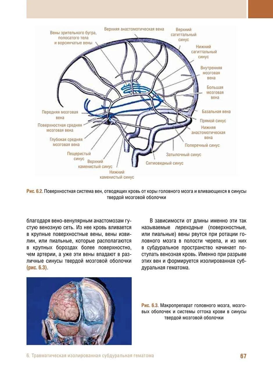 Синусы твердой оболочки мозга. Пещеристый синус твердой мозговой оболочки. Синусы твердой оболочки головного мозга. Синусы твердой оболочки. Повреждение мозговых оболочек.