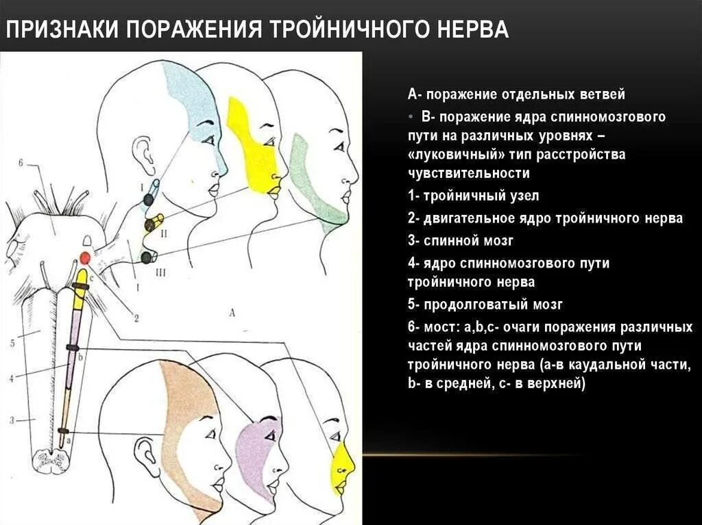 Лечение тройничного нерва после. Путь тройничного нерва неврология. Центральный Тип поражения тройничного нерва. Симптомы поражения тройничного нерва неврология. Симптомы поражения ветвей тройничного нерва.