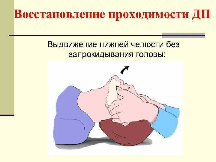 Выдвижение вперед. Выдвижение вперед