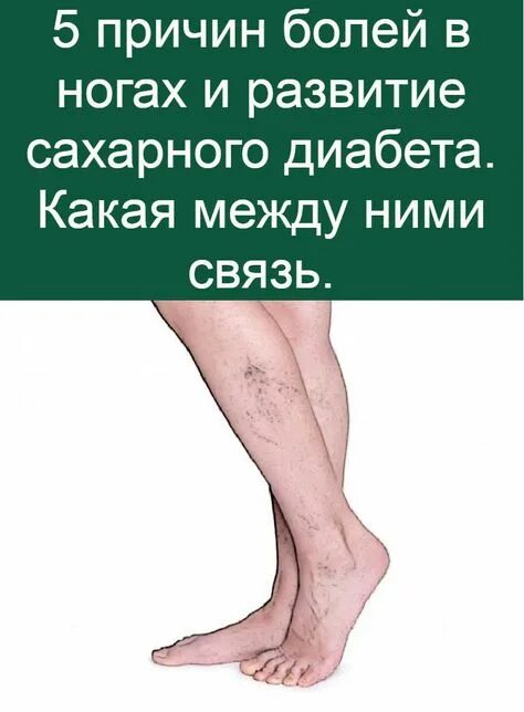 Диабетическая стопа: причины, симптомы, виды, лечение, когда нужна ампутация, ка