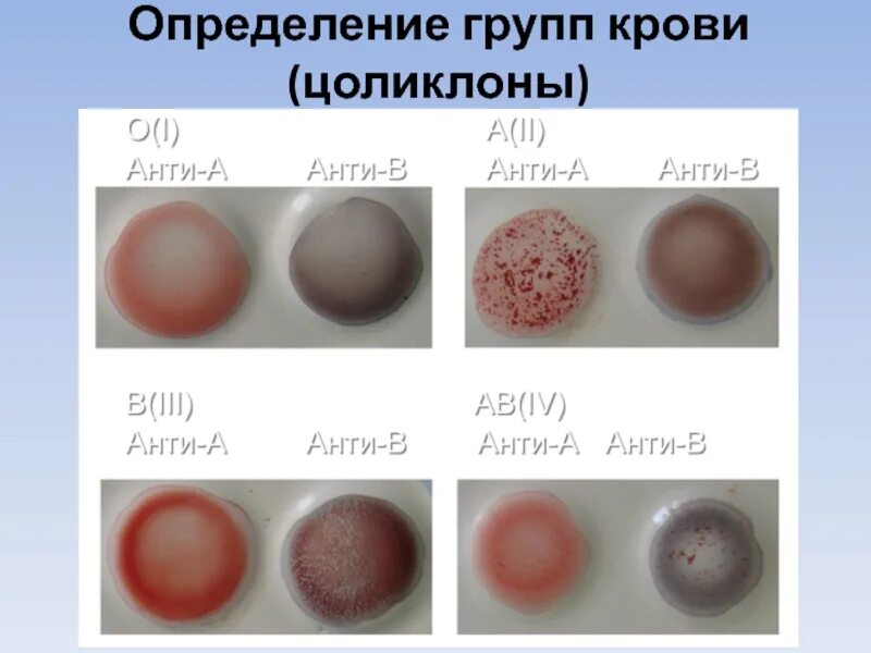 Переливание крови