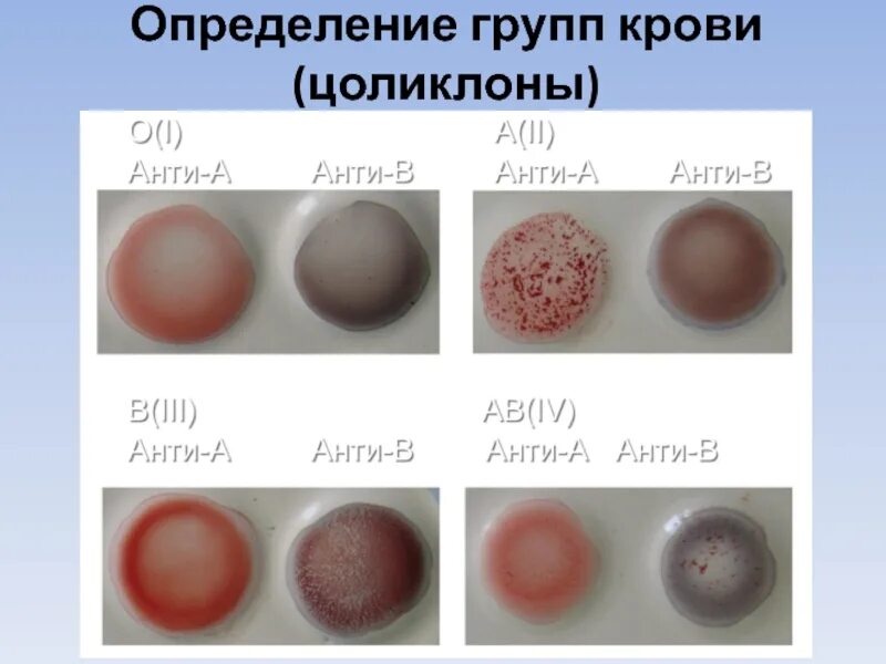 Определение группы крови и резус цоликлонами