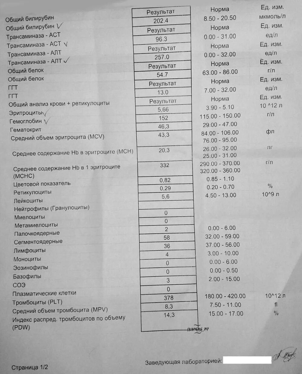 Алт анализ крови у ребенка. Биохимия анализ крови показатели АСТ что это. Показатель анализа крови AST. Показатели биохимии...алт, АСТ норма. Анализ крови алт и АСТ норма для женщин.