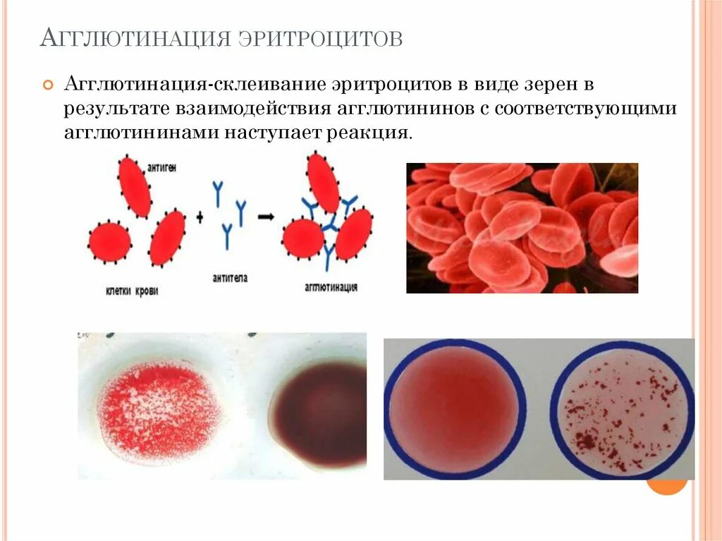 В пробирке произошла агглютинация это означает. Механизм агглютинации эритроцитов. агглютинация это склеивание эритроцитов.