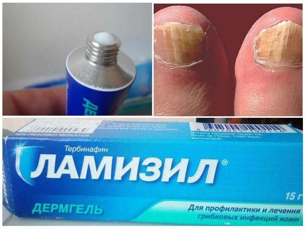 Ламизил уно спрей. Ламизил капли для ногтей. Мазь для грибок ноги ламизил. Lamisil для ног от грибка ногтей. Средство от грибка спрей.