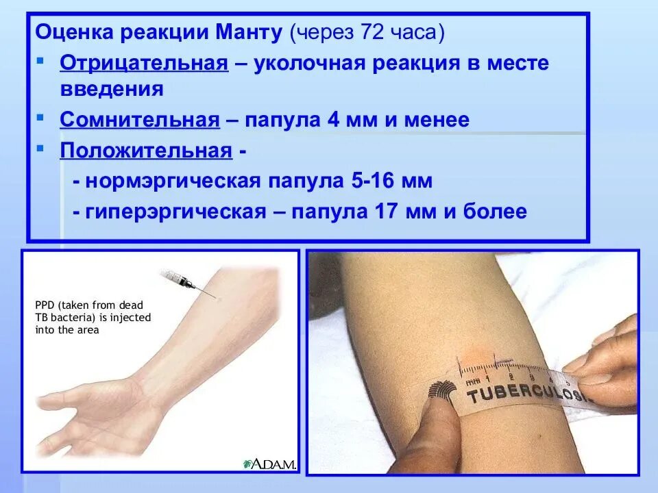 Через сколько дней после манту можно мыться