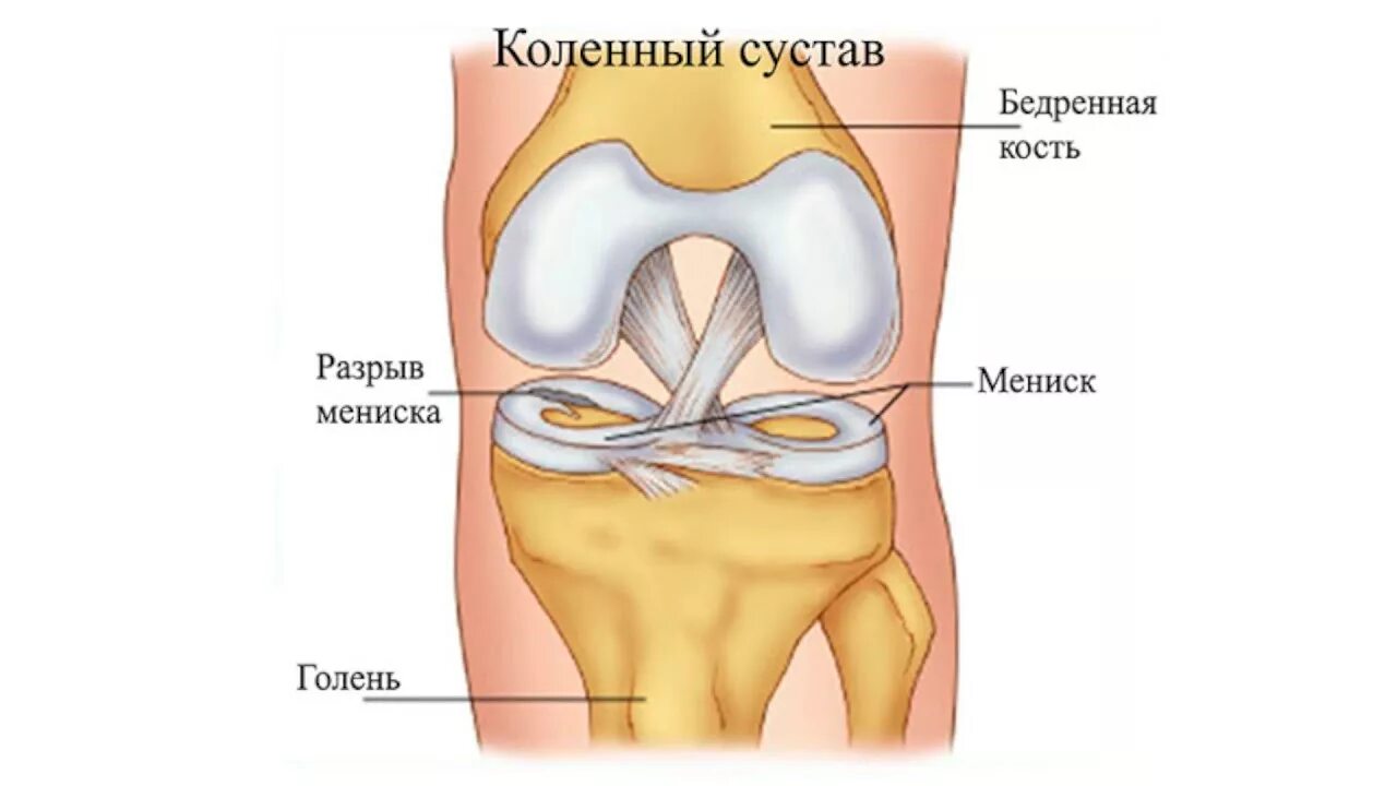 Болит ли мениск. Коленный мениск анатомия. Мениски коленного сустава анатомия. Строение колена-мениск анатомия. Коленный сустав строение мениск.