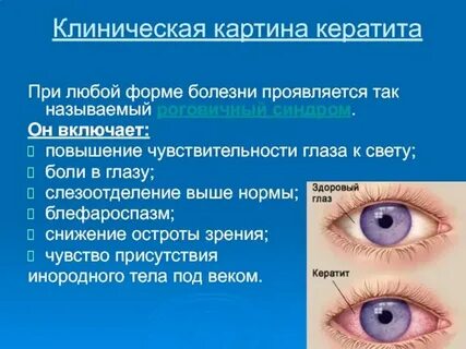 Боль в глазном яблоке причины