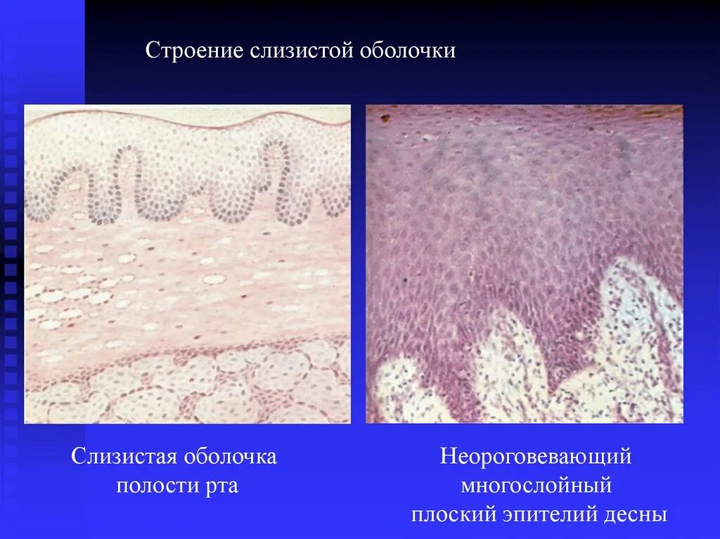 Слои слизистой полости рта. Многослойный эпителий ротовой полости. Многослойный плоский неороговевающий эпителий полости рта. Строение слизистой оболочки полости рта. Слизистая оболочка полости рта строение.