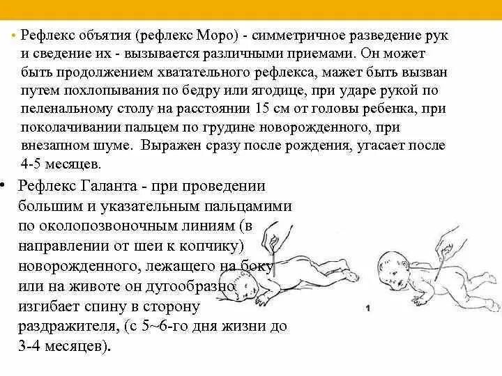 Рефлексы Моро у новорожденного. Рефлекс Моро у грудничка в 2 месяца. Рефлексы новорожденного Бабинского Моро. Рефлекс Моро у грудничка в 6 месяцев.