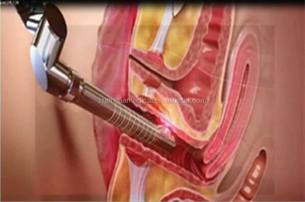 Zygote::3D Female Reproductive System Model Medically Accurate Human