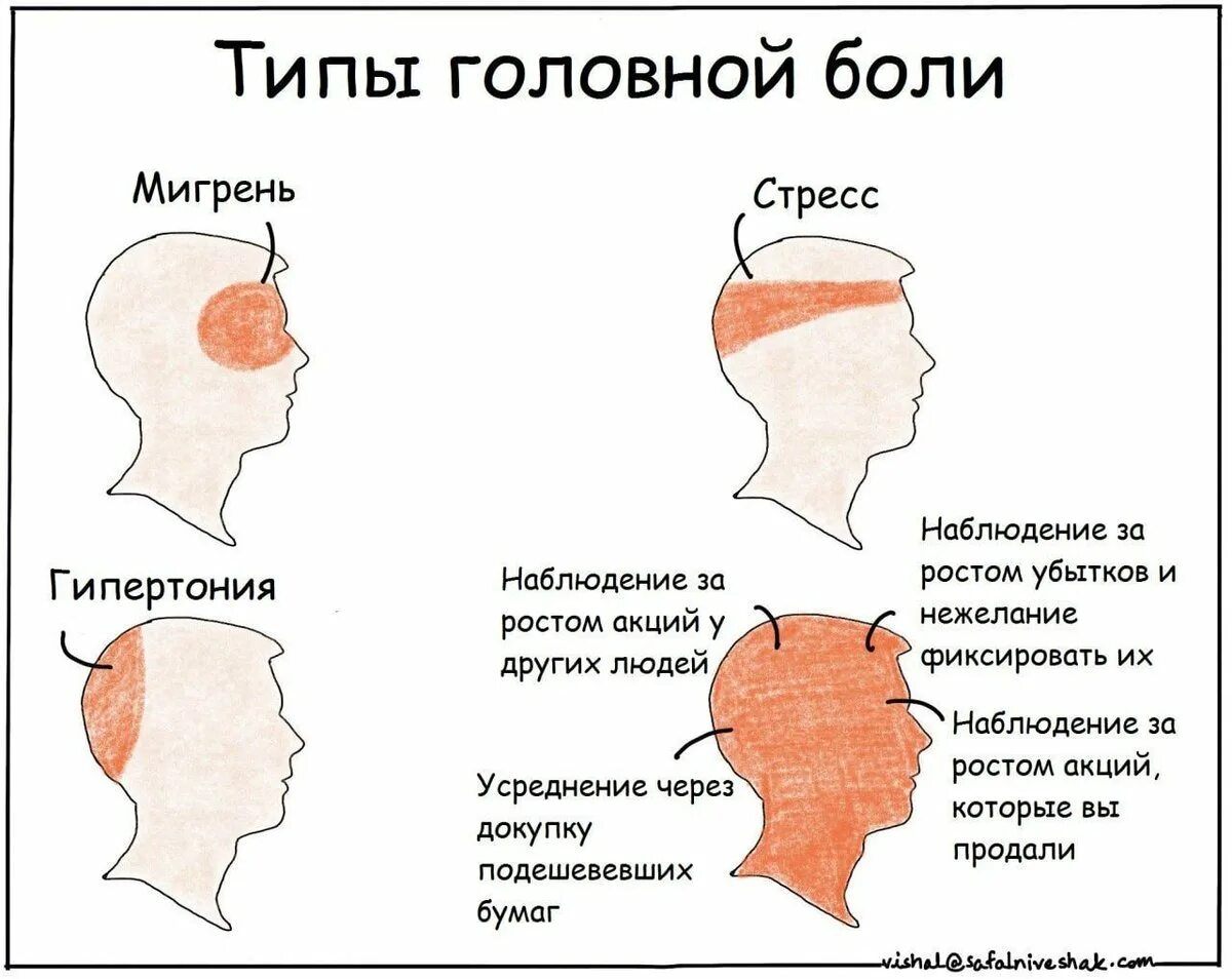 Болит в области лба и давит. Типы головной боли. Вилюды, головной боли. Локализация глазной боли. Головная боль локализация.