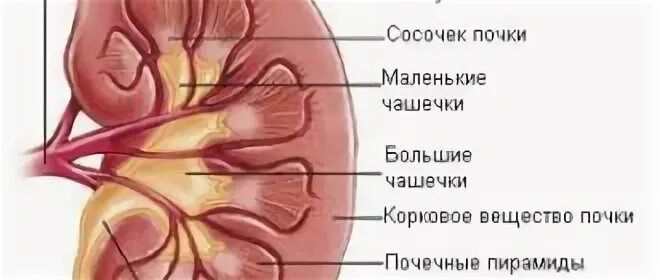 Синусы обеих почек