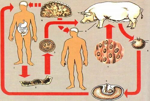 Может ли человек заразиться бычьим цепнем. Свиной цепень цистицеркоз. Свиной цепень тениоз и цистицеркоз.