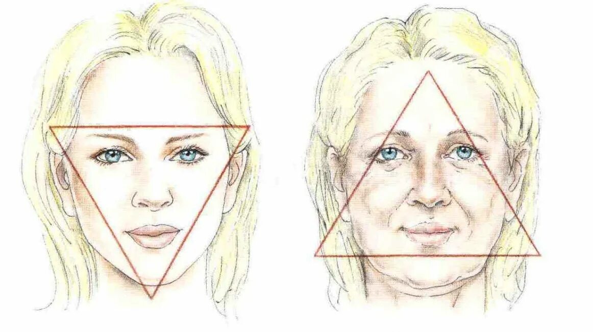 Гравитационный птоз лица. Гравитационный птоз Тип старения. Треугольник молодости.