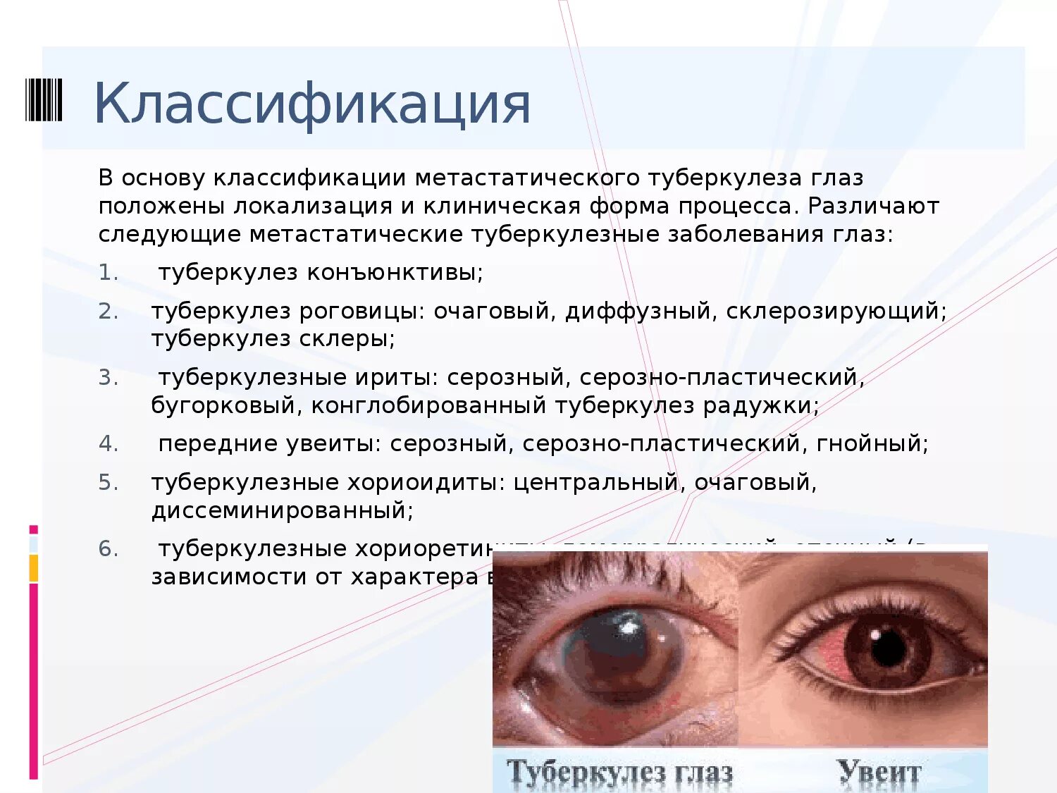 Значение правого глаза. Кератит – воспаление роговицы глаза.. Туберкулезные заболевания глаз.