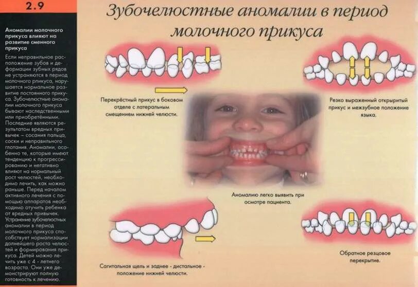 Период формирования прикуса временных зубов. Периоды молочного прикуса. Прикус молочных (временных) зубов. Период сформированного прикуса постоянных зубов. Профилактика временного прикусе.