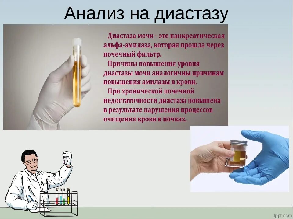 Анализ мочи на гестазу. Исследование мочи на диастазу. Показатели мочи на диастазу. Анализ мочи диастаза мочи.