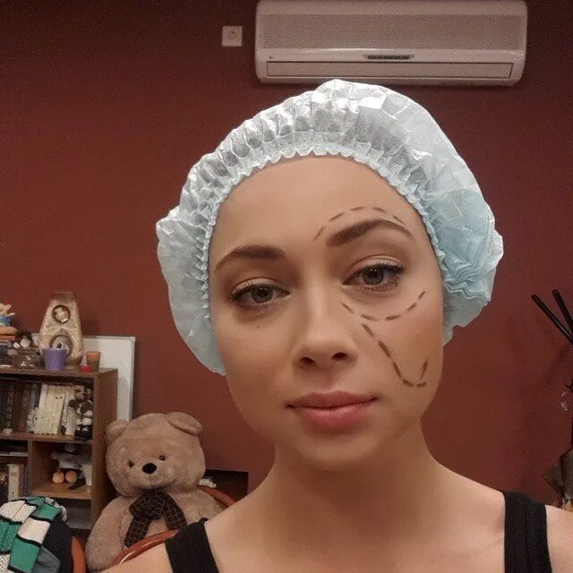 Настасья самбурская ринопластика. Самбурская настасья пластические операции. Самбурская до и после пластики. Самбурская до и после пластики. Настасья самбурская пластика.