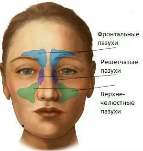 Синусит можно греть нос. Лобная пазуха клиновидная пазуха. Гайморит этмоидит сфеноидит. Лобная фронтальная пазуха.