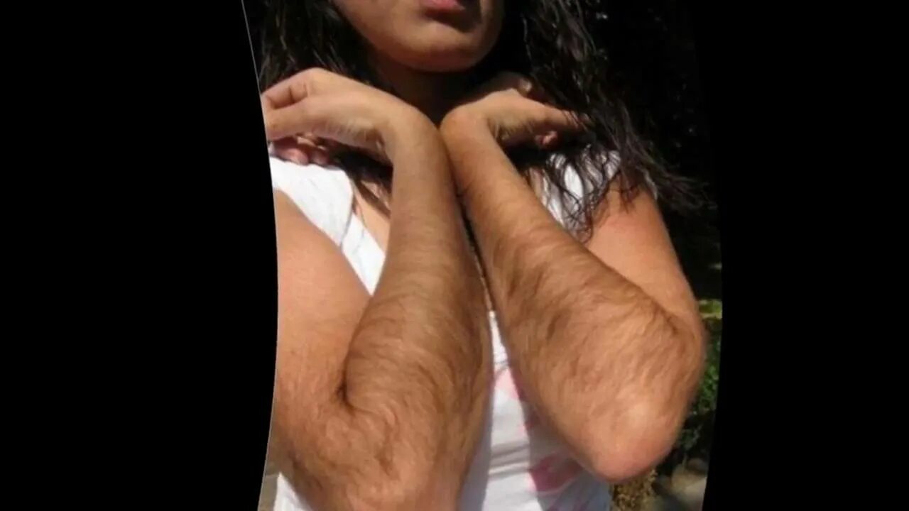 Волосы на руках у девушки. Растут волосы на руках у девушки. Алисса милано волосы на руках. Волосы на руках у девушки. Волосы на руках у девушки.