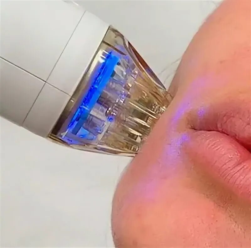 Микроигольчатая процедура. Микроигольчатая процедура. Микроигольчатая процедура. Микроигольчатая процедура. Микроигольчатая процедура.