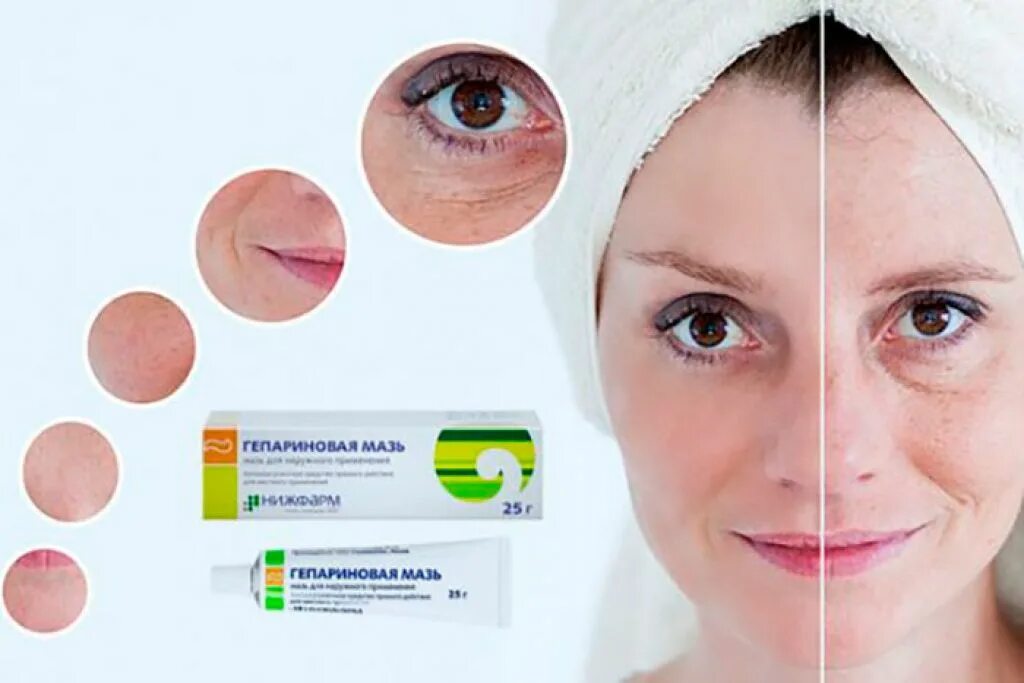 гепариновая мазь для лица от отеков. гепариновая мазь от прыщей. мазь от морщин под глазами. Stada мазь. гепариновая мазь от синяков под глазами.
