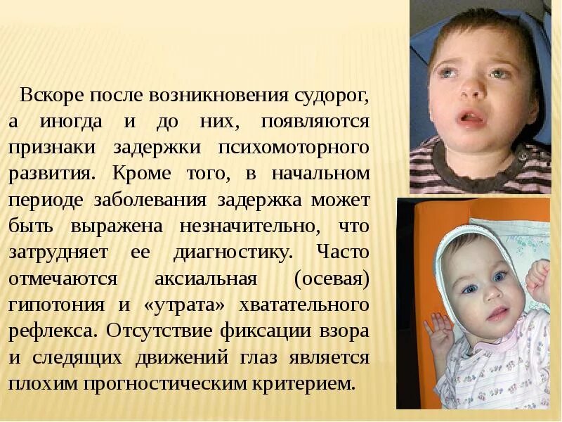 Туберкулезный склероз. Фотографии людей, больных туберозным склерозом.