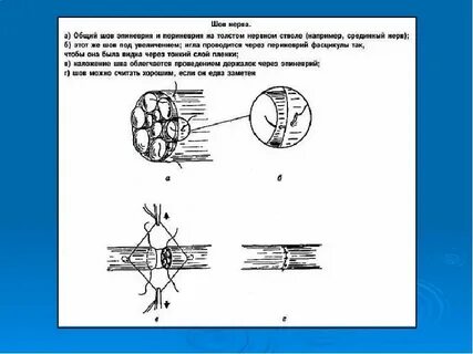 Сшивание нерва на латинском