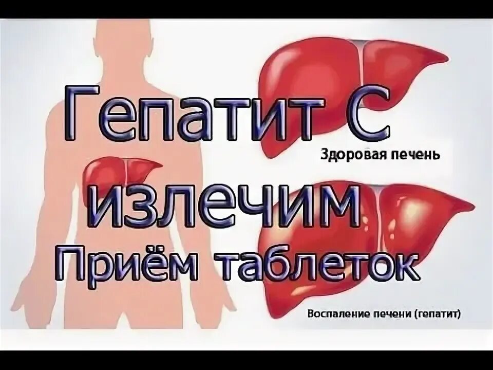 Гепатит врач отзывы. Гепатит с излечим. Гепатит с излечим или нет. Как кровь почистить от гепатита.