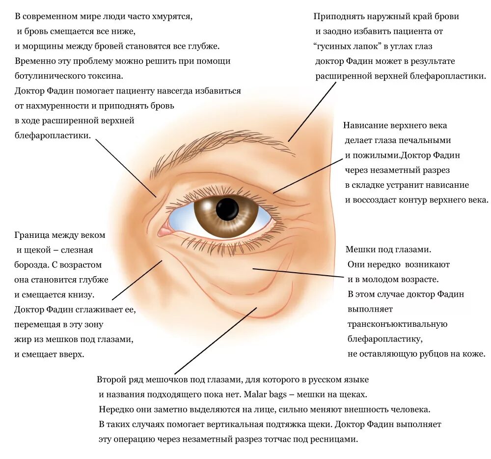 Отекшие глаза причины и лечение у женщин. Мешки под глазами сбоку причины. Периорбитальная зона (верхнее и нижнее веко). Строение Нижнего века глаза.
