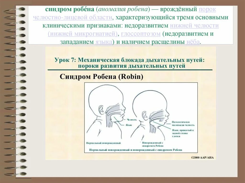 Аномалии челюстно лицевой области. Пороки челюстно лицевой области. Аномалии развития челюстно лицевой области. Врожденные дефекты челюстно лицевой области.