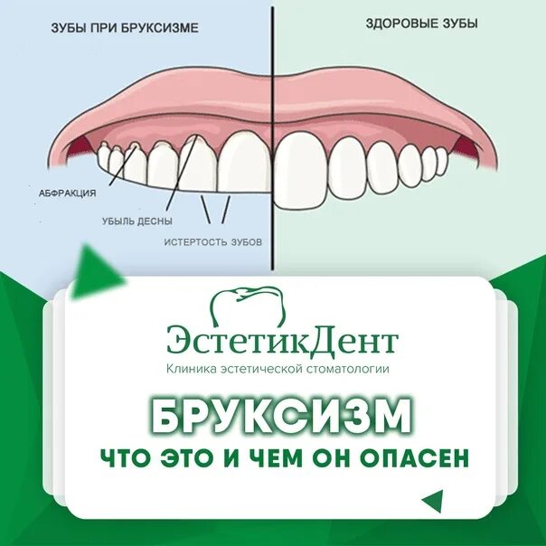 Скрипт во сне зубами