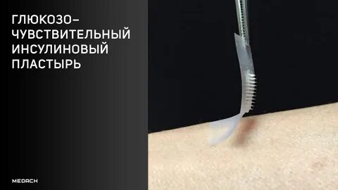 Имплант диабет