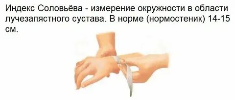 Размер таза индекс соловьевой