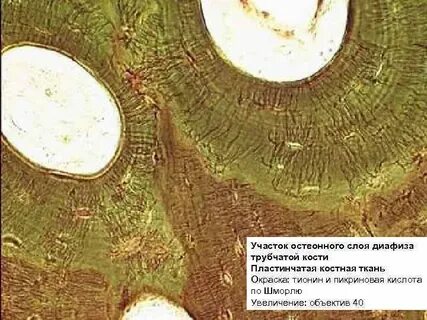 Поперечный срез костной ткани