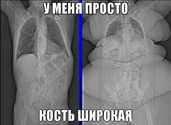 Skeleton Bones Изображения: просматривайте стоковые фотографии, векторные изобра