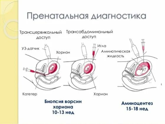 Биопсия хориона это. Исследование ворсин хориона. методы пренатальной диагностики биопсия хориона. оптимальные сроки проведения биопсии хориона. трансабдоминальная биопсия ворсин хориона.
