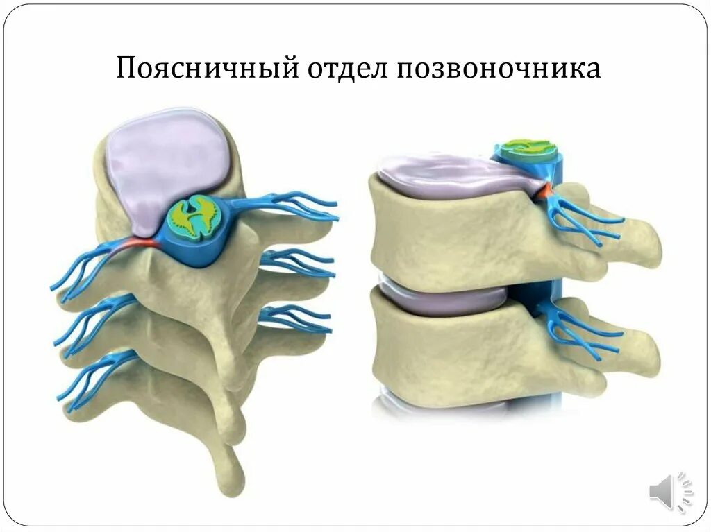 Имплант позвонка поясничного отдела. Эндопротез межпозвонкового диска m6. Имплантация межпозвоночного диска поясничного отдела. M6 диск межпозвонковый.