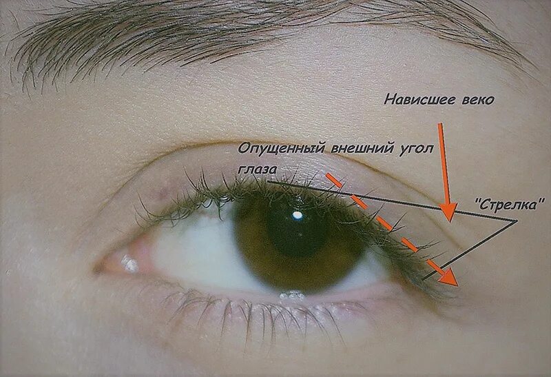 Почему появляются стрелки. Внешний уголок глаза. Внутренний и внешний уголок глаза. Схема наращивания внешних уголков глаз. Схема наращивания для нависшего века.