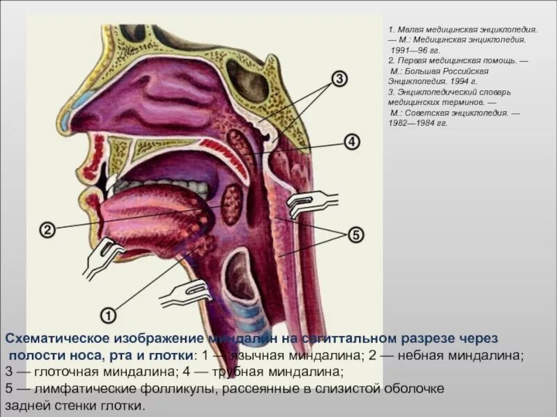 Полость носа и глотки. Миндалины Сагиттальный срез. Миндалины лимфоэпителиального кольца. Строение носоглотки миндалины. Глоточная и трубные миндалины.