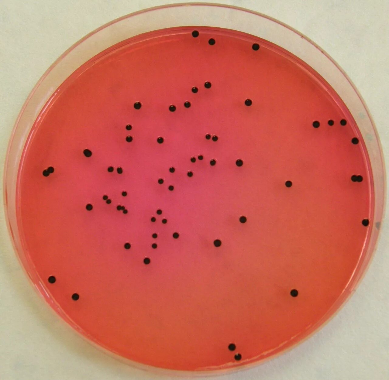 Spp salmonella spp shigella spp